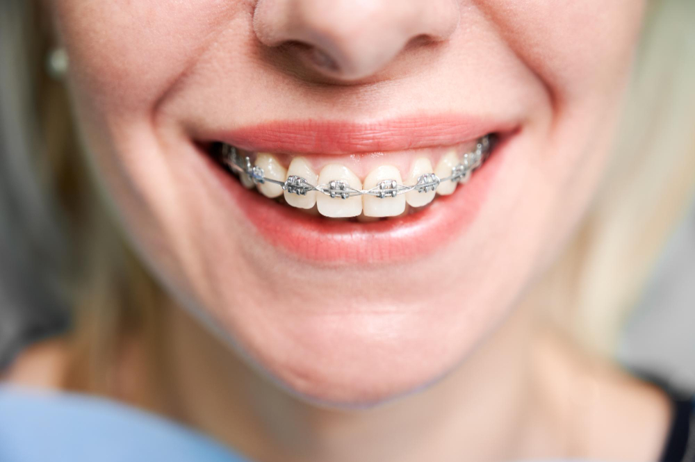 happy young woman in dentist chair
